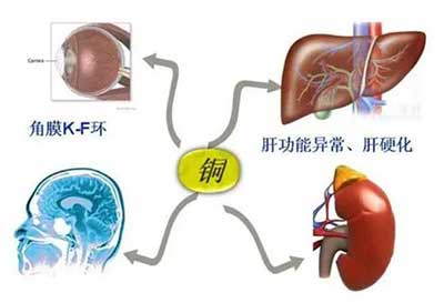 人体榴莲app破解版数据能够准检测出但身体中微量元素铜超标会引起疾病发生